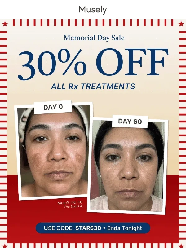 Musely - Time’s almost up! Still want 30% OFF? ⏳
