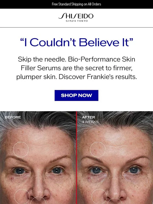 Shiseido - "I don't use Botox or fillers…this is a beautiful alternative"