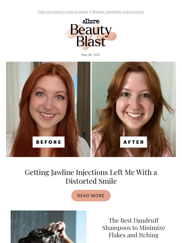 Allure - Getting Jawline Injections Left Me With a Distorted Smile